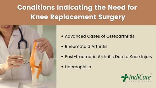 Indications for Knee Replacement Surgery